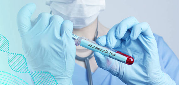 SingleB單抗發(fā)現(xiàn)技術(shù)攻克PCT檢測靈敏度難題 