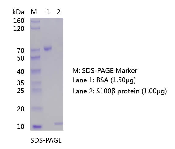 歐凱生物S100β蛋白的SDS-PAGE和WB分析圖